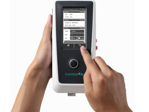 Analizzatore immunologico di fluorescenza GIMA - portatile per test diagnostici rapidi e precisi
