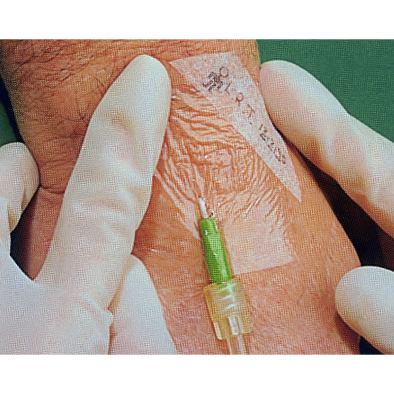 TEGADERM 3M – 6 x 7 cm