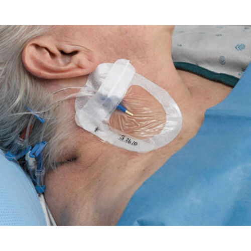 medicazione Tegaderm™ 3M I.V. Advanced 8,5 x 11,5 cm