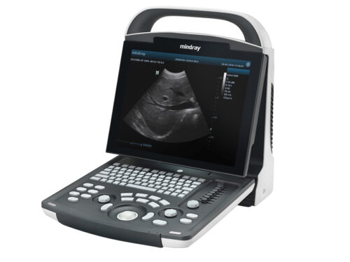 Ecografo portatile Mindray DP-20 con monitor LED 12.1” e imaging avanzato B/N