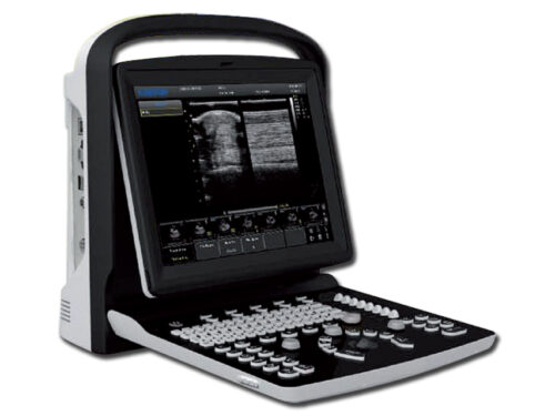 ECOGRAFO CHISON ECO-3 VET
