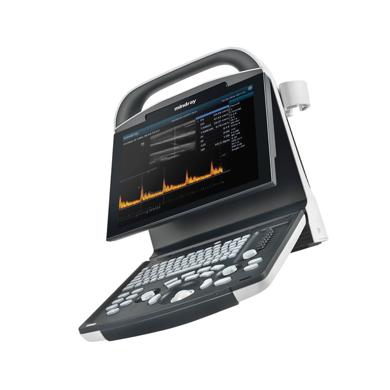ECOGRAFO MINDRAY DP-10 – portatile con monitor