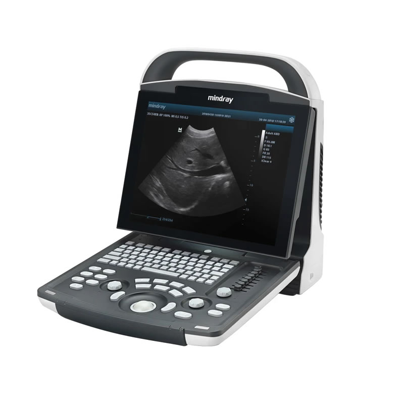 ECOGRAFO MINDRAY DP-10 – portatile – con monitor LED 12.1