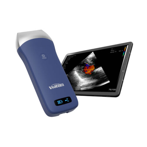 ECOGRAFO PORTATILE LINEARE WIRELESS VIATOM