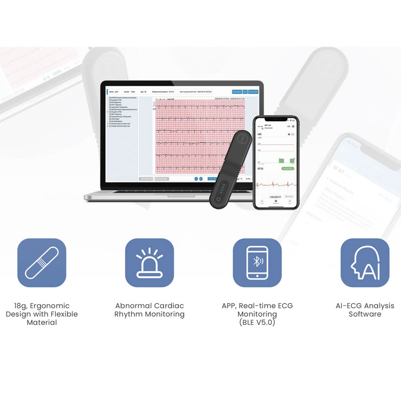 REGISTRATORE ECG DINAMICO display