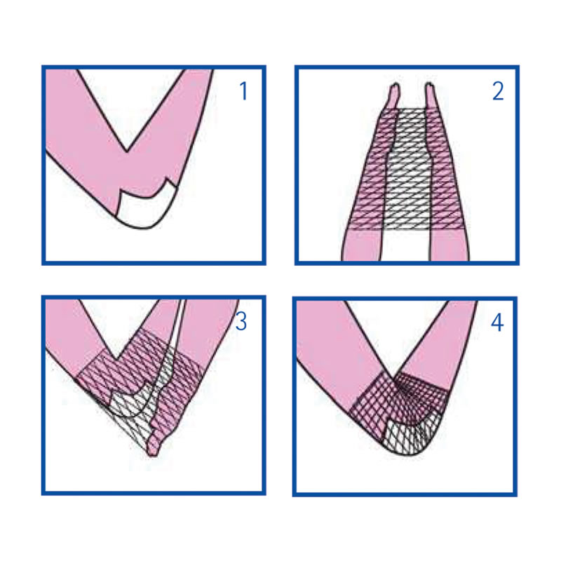 RETE TUBOLARE ELASTICA – calibro C per braccio e spalla – DISEGNO