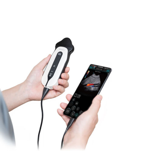 SONOEYE P6 DOPPLER DIGITALE A COLORI