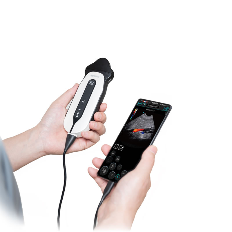 SONOEYE P6 DOPPLER DIGITALE A COLORI